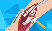 Arm Surgery 2 gratuit sur Jeu.org